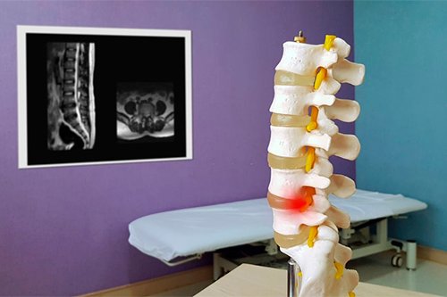 cirujano de columna cerca de mi