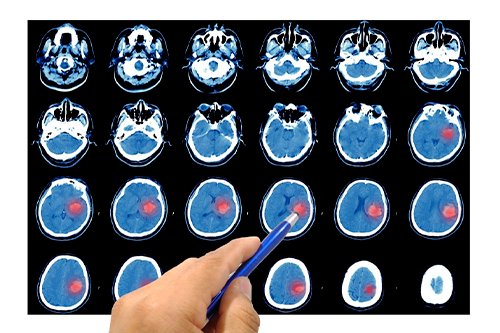 neurocirujano en gustavo a madero