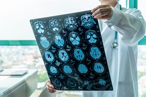 neurocirujano en star medica