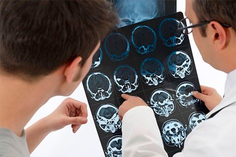 Especialista en Cirugía aneurisma cerebral en Tlalnepantla de Baz Estado de México