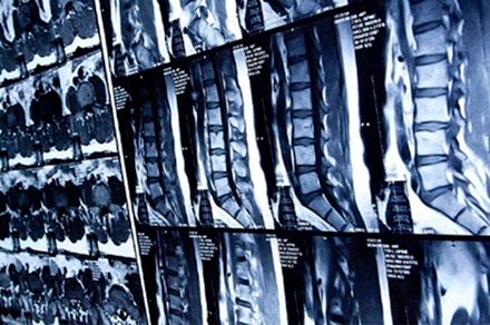 Especialista en Fracturas craneales en Lindavista CDMX