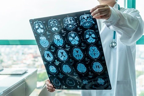 Precio de consulta de Cirugía epilepsia en Tlalnepantla de Baz Estado de México