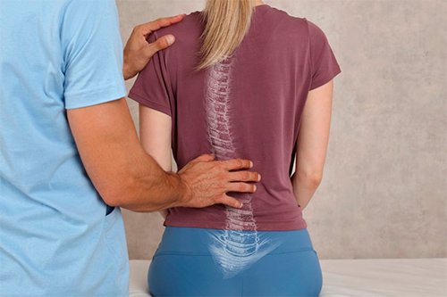 Precio de consulta de Hernia de disco en Lindavista CDMX